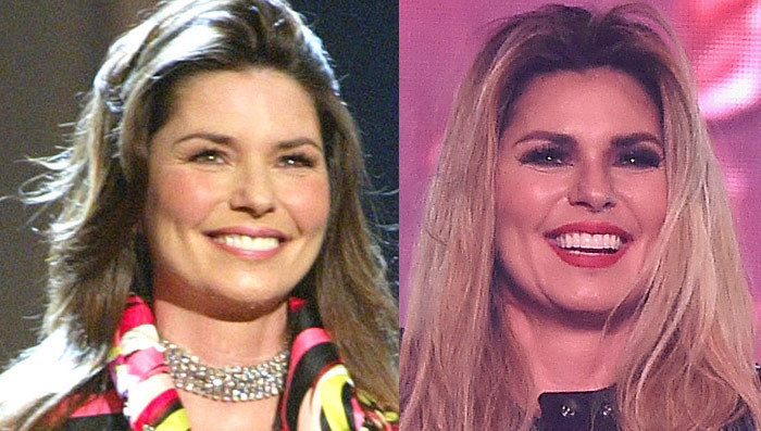 Shania Twain: Good Genes or Good Docs?!