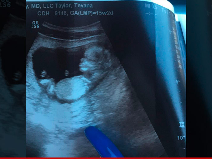 Iman Shumpert -- I Knocked Up Teyana Taylor ... Pumped For 'Iman Jr.'