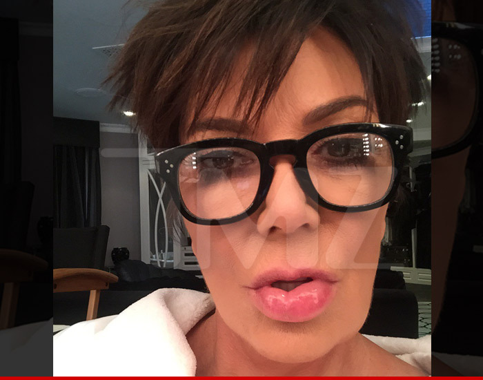 Kris Jenner -- Here's My Proof ... A Spider Made Gave Me a Fat Lip (PHOTO)