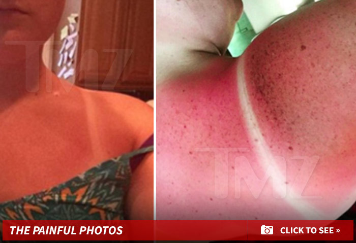 Jessica Alba's Company -- Sunscreen Lawsuit -- You Burned Our Kids!!!