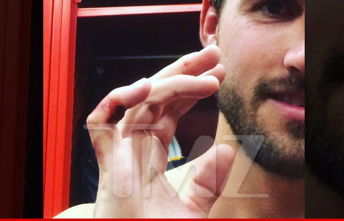 'The Bachelorette' Star JJ Lane -- Someone Almost Bit My Pinky Off During Hockey Game (PHOTOS)