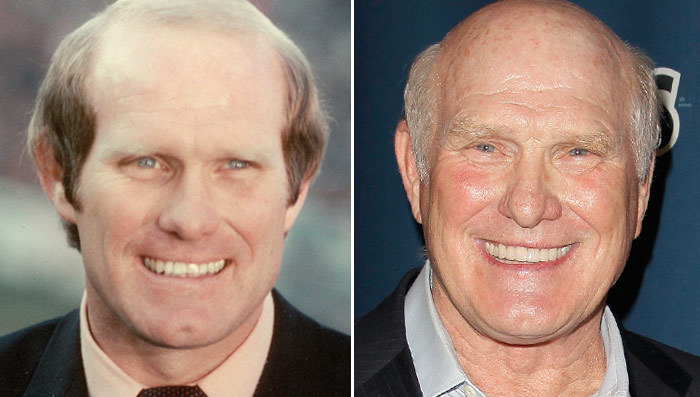 Terry Bradshaw: Good Genes or Good Docs?!