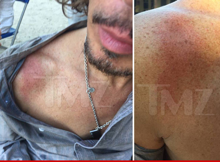 Chris Cornell -- Burned On Music Video Set in Mock Hanging (PHOTOS)
