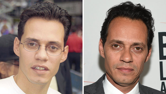 Marc Anthony: Good Genes or Good Docs?!