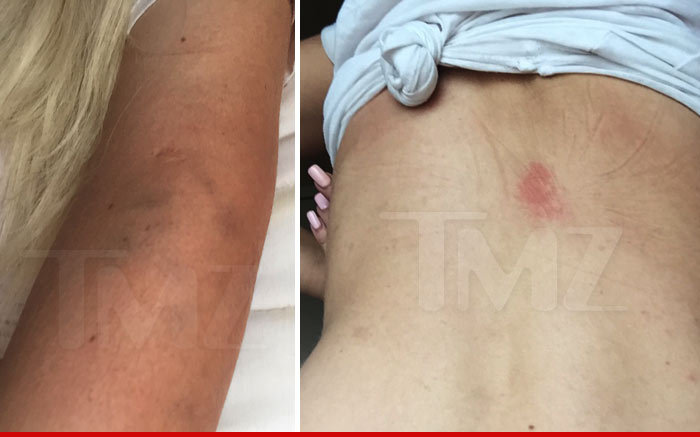 Chris Brown -- New Accuser Says I Have Picture Proof He Assaulted Me