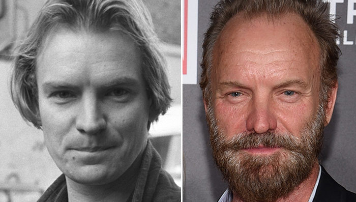 Sting: Good Genes or Good Docs?!