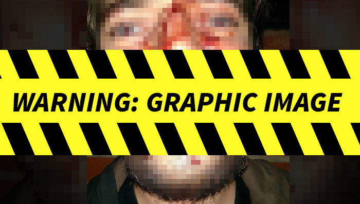 Danzig – Cops Investigate Alleged Fan Assault