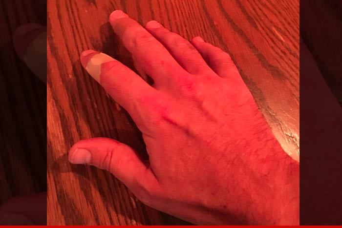Jimmy Fallon -- My Jager-Bombed Hand Is All Good (PHOTO)