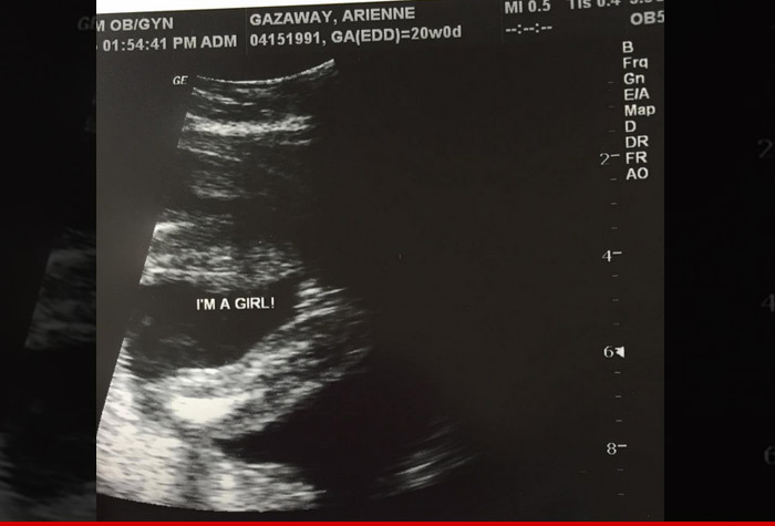 Adrien Broner -- My Chick's Pregnant ... With My 7th Baby!!!