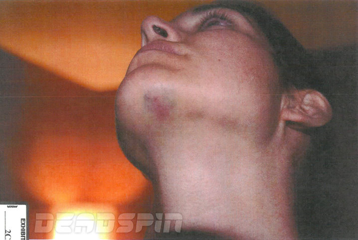 Greg Hardy -- Brutal Pics From Dom. Violence Case Exposed