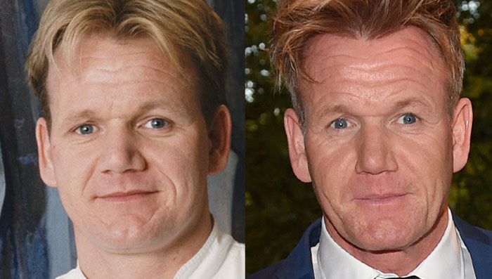 Gordon Ramsay: Good Genes or Good Docs?!