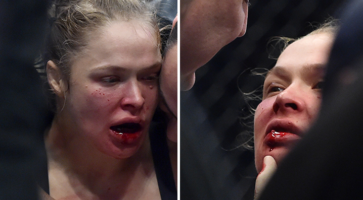 Ronda Rousey -- 'Depressed' and 'Bummed' ... There Will Be a Rematch!