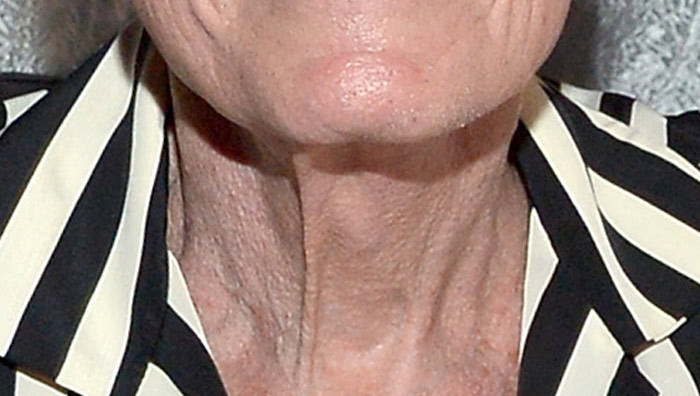 Guess the Gobbler -- See Whose Turkey Neck!