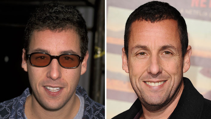 Adam Sandler -- Good Genes Or Good Docs?