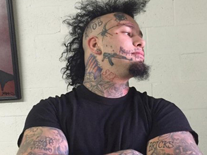 stitches tattoo removal company offers to fix his face stitches tattoo removal company offers to fix his face