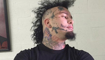 Stitches -- Tattoo Removal Company Offers To Fix His Face