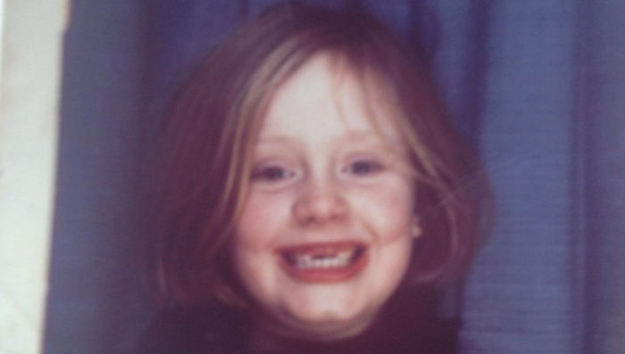 Guess Who This Toothless Tot Turned Into!