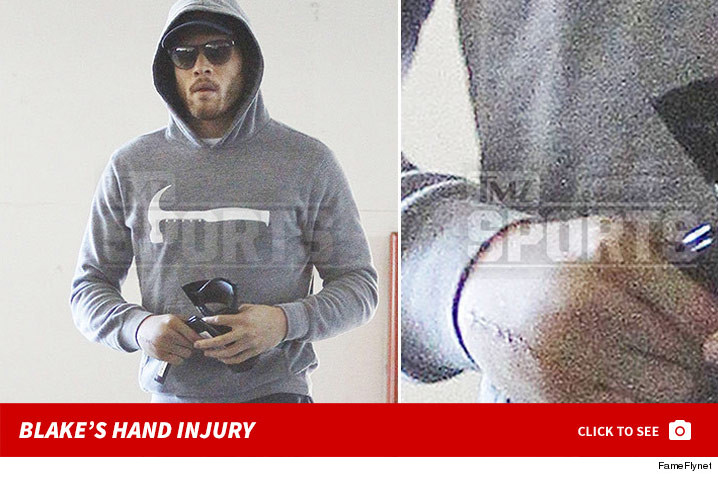 0209_blake_griffin_hand_injury_footer