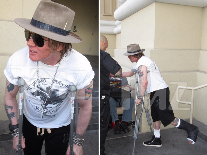 Axl Rose The Greatest Transformation of 2016 Page 2 GUNS N' ROSES