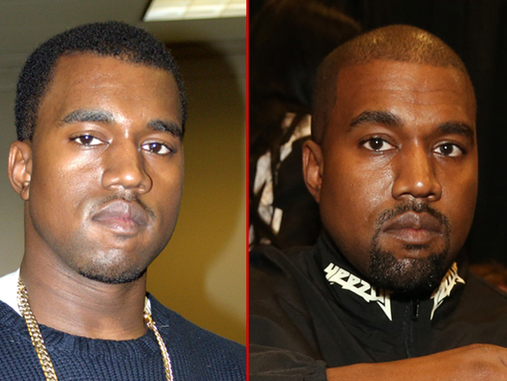 Kanye West &ndash; Good Genes or Good Docs? - TMZ