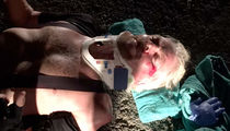 Richard Branson -- If My Face Didn't Break My Fall ... I'd Be DEAD! (PHOTOS)