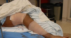 Aqib Talib Gunshot Photos Released ... After NFL&hellip;