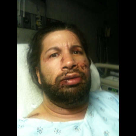 Shane Helms' Crazy Crash Photos