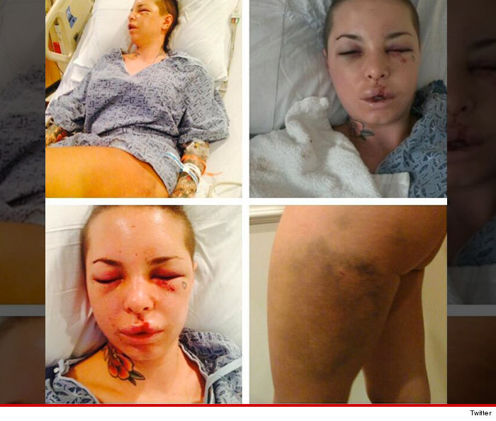 0811-christy-mack-injuries-twitter-02